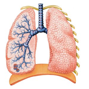 Quy định về khám chữa bệnh bảo hiểm y tế liên quan bệnh lao